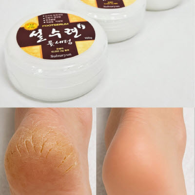 [설수련] 약국용 우레아 발각질 풋세럼 100g 1+1+1 (사은품 증정) 대표이미지 섬네일